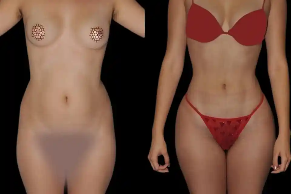 Before-and-after-liposuction-surgery-lipo-fat-removal